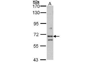 WB Image Sample (30 ug of whole cell lysate) A: Hela 7. (EXOC7 Antikörper)