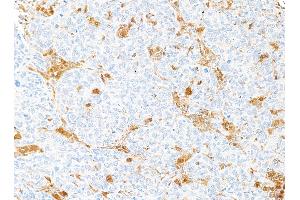 anti-Lectin, Galactoside-Binding, Soluble, 9 (LGALS9) (AA 305-355) antibody