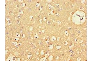 Immunohistochemistry of paraffin-embedded human brain tissue using ABIN7146119 at dilution of 1:100 (CXCL11 Antikörper  (AA 22-94))