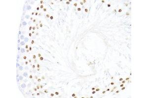 Immunohistochemistry of paraffin-embedded Rat testis using DDX59 Polyclonal Antibody at dilution of 1:100 (40x lens). (DDX59 Antikörper)