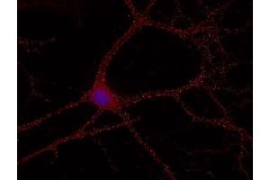 Indirect immunostaining of methanol fixed hippocampus neurons (dilution 1 : 500; red). (RAB5 Antikörper)