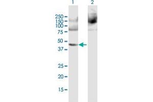 Western Blot analysis of PPME1 expression in transfected 293T cell line by PPME1 MaxPab polyclonal antibody. (PPME1 Antikörper  (AA 1-386))