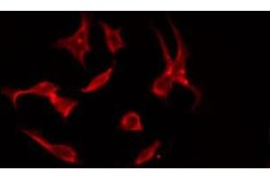 ABIN6275575 staining NIH-3T3 by IF/ICC. (SLC4A11 Antikörper  (Internal Region))