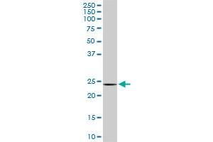 Western Blotting (WB) image for anti-Defective in Cullin Neddylation 1, Domain Containing 1 (DCUN1D1) (AA 1-89) antibody (ABIN527034)