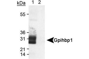 Western blot analysis of Gpihbp1 in transfected lysate (Lane 1) using Gpihbp1 polyclonal antibody . (GPIHBP1 Antikörper  (AA 170-250))
