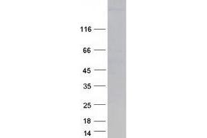 Western Blotting (WB) image for Myosin Heavy Chain 6, Cardiac Muscle, alpha (MYH6) protein (Myc-DYKDDDDK Tag) (ABIN2726659)