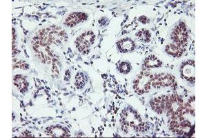 Immunohistochemical staining of paraffin-embedded Human breast tissue using anti-RNF113B mouse monoclonal antibody. (RNF113B Antikörper)