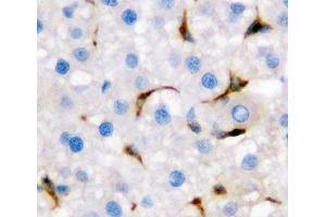 IHC-P: CD68 antibody testing of rat liver tissue (CD68 Antikörper  (AA 312-326))
