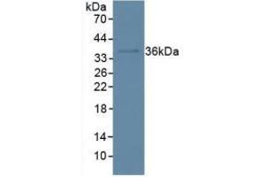 Detection of IkBa in Human Hela Cells using Polyclonal Antibody to Inhibitory Subunit Of NF Kappa B Alpha (IkBa) (Inhibitory Subunit Of NF kappa B alpha (AA 74-247) Antikörper)