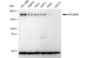 Western blotting analysis using EIF2AK4 antibody (ABIN7798505). (Rekombinanter GCN2 Antikörper)