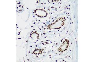 Immunohistochemistry of paraffin-embedded human breast using TriMethyl-Histone H3-K64 antibody (ABIN7267701) at dilution of 1:100 (40x lens).