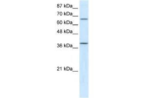 ACADM antibody used at 5 ug/ml to detect target protein. (Medium-Chain Specific Acyl-CoA Dehydrogenase, Mitochondrial (N-Term) Antikörper)