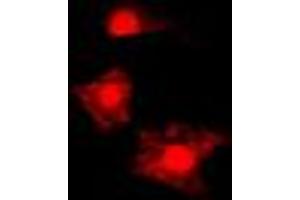 Immunofluorescent analysis of FAST Kinase staining in HL60 cells. (FASTK Antikörper  (Center))