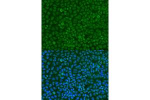 Immunofluorescence analysis of U2OS cells using YWHAZ antibody. (14-3-3 zeta Antikörper  (C-Term))
