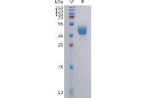 SDS-PAGE (SDS) image for Chemokine (C-C Motif) Receptor 2 (CCR2) (AA 1-42) protein (mFc Tag) (ABIN7491157)