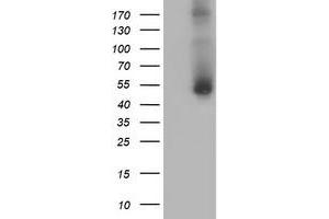 Western Blotting (WB) image for anti-Golgi Membrane Protein 1 (GOLM1) antibody (ABIN1498498) (GOLM1 Antikörper)