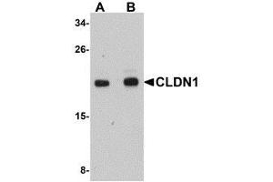 Western blot analysis of CLDN1 in HepG2 cell lysate with AP30236PU-N CLDN1 antibody at (A) 1 and (B) 2 μg/ml. (Claudin 1 Antikörper  (C-Term))
