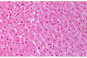Anti-SOD1 antibody IHC staining of human liver, hephatocytes. (SOD1 Antikörper)