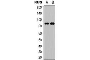 Western blot analysis of FRS2 (pY436) expression in Jurkat (A), Huvec (B) whole cell lysates. (FRS2 Antikörper  (C-Term, pTyr436))