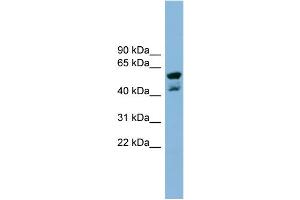 WB Suggested Anti-PPME1  Antibody Titration: 0. (PPME1 Antikörper  (N-Term))