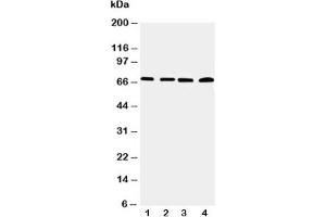 Western blot testing of IRAK2 antibody and Lane 1:  22RV;  2: A549;  3: PANC;  4: SMMC-7721 cell lysate