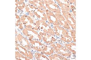 Immunohistochemistry of paraffin-embedded human stomach using HMGA1 antibody. (HMGA1 Antikörper)