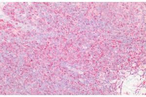 Detection of PTPN2 in Human Tonsil Tissue using Polyclonal Antibody to Protein Tyrosine Phosphatase, Non Receptor Type 2 (PTPN2) (PTPN2 Antikörper  (AA 1-257))