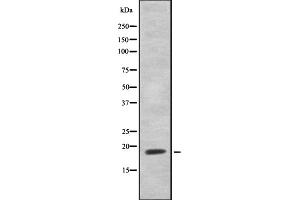 Western blot analysis of HEN1/2 using Jurkat whole cell lysates (HEN1/2 Antikörper)