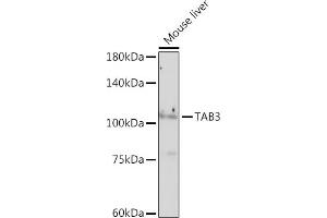 Western blot analysis of extracts of Mouse liver, using T antibody (ABIN7270793) at 1:1000 dilution.