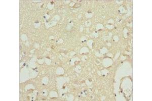 Immunohistochemistry of paraffin-embedded human brain tissue using ABIN7175594 at dilution of 1:100 (CACNB1 Antikörper  (AA 429-598))