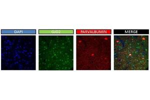 Immunohistochemistry (IHC) image for anti-Gap Junction Protein, delta 2, 36kDa (GJD2) (Middle Region) antibody (ABIN2774866)