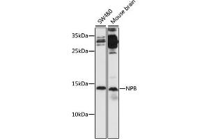 Western blot analysis of extracts of various cell lines, using NPB antibody (ABIN7268885) at 1:1000 dilution. (Neuropeptide B Antikörper  (AA 1-125))