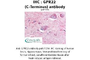 Image no. 1 for anti-G Protein-Coupled Receptor 22 (GPR22) (C-Term), (Cytoplasmic Domain) antibody (ABIN1735032) (GPR22 Antikörper  (C-Term, Cytoplasmic Domain))
