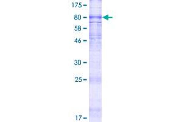 ABCC11 Protein (AA 1-553) (GST tag)