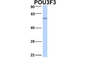 Host:  Rabbit  Target Name:  POU3F3  Sample Type:  Human Fetal Lung  Antibody Dilution:  1. (POU3F3 Antikörper  (N-Term))