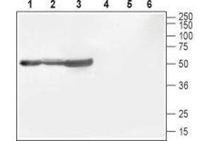 Western blot analysis of rat brain (lanes 1 and 4), mouse brain (lanes 2 and 5) and rat cortex (lane 3 and 6): - 1-3. (CACNB1 Antikörper  (Intracellular))