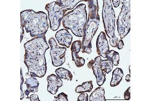 IHC analysis of VAPA using anti-VAPA antibody (ABIN7603249). (VAPA Antikörper  (N-Term))