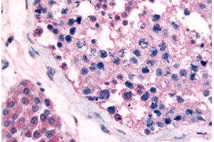 Human Testis (formalin-fixed, paraffin-embedded) stained with GPR18 antibody ABIN213453 at 5 ug/ml followed by biotinylated goat anti-rabbit IgG secondary antibody ABIN481713, alkaline phosphatase-streptavidin and chromogen. (GPR18 Antikörper  (Cytoplasmic Domain))