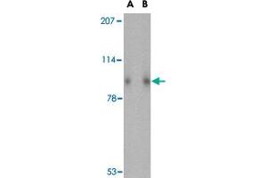 Western blot analysis of SLITRK1 in human brain tissue lysate with SLITRK1 polyclonal antibody  at (A) 1 and (B) 2 ug/mL . (SLITRK1 Antikörper  (Internal Region))