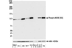 Western Blotting (WB) image for anti-Minichromosome Maintenance Complex Component 2 (MCM2) (pSer53) antibody (ABIN7449430) (Rekombinanter MCM2 Antikörper  (pSer53))