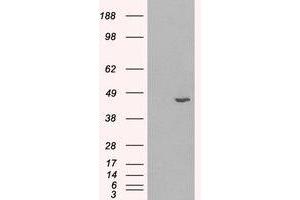 Image no. 1 for anti-Hydroxysteroid (11-Beta) Dehydrogenase 1 (HSD11B1) (C-Term) antibody (ABIN374673) (HSD11B1 Antikörper  (C-Term))