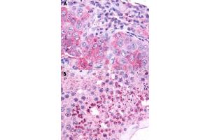Immunohistochemical staining of formalin-fixed paraffin-embedded human lung (A) and human testis (B) with nMBR polyclonal antibody . (NMBR Antikörper  (Cytoplasmic Domain))