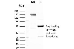 SDS-PAGE Analysis Purified GLUT-1 Recombinant Rabbit Monoclonal Antibody (GLUT1/3132R). (Rekombinanter GLUT1 Antikörper  (AA 203-305))