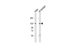 All lanes : Anti-Enpp1 Antibody (N-term) at 1:1000 dilution Lane 1: Hela whole cell lysate Lane 2: mouse bladder lysate Lysates/proteins at 20 μg per lane. (ENPP1 Antikörper  (N-Term))