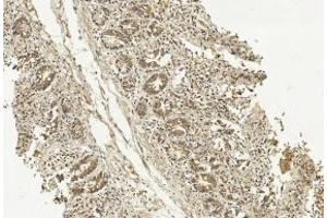 Immunohistochemical analysis of paraffin-embedded Human Small intestine section using Pink1 (ABIN1539798 and ABIN2843775).