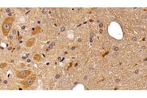 Immunohistochemistry (IHC) image for anti-Ionized Calcium-binding Adapter Molecule 1 (IBA1) (AA 1-147) antibody (ABIN7427558)