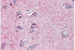 Brain, cortex, Human: Formalin-Fixed, Paraffin-Embedded (FFPE) (NTSR2 Antikörper  (Internal Region))