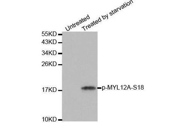 MYL12A Antikörper  (pSer18)