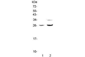 Western blot testing of rat 1) PC-12 and 2) RH35 lysate with Betacellulin antibody at 0.