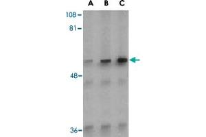 Western blot analysis of Irak2 in A-20 whole cell lysate with Irak2 polyclonal antibody  at (A) 0.